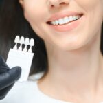 Are Veneers Reversible and What To Know