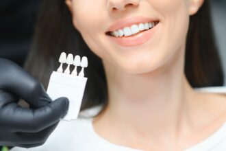 Are Veneers Reversible and What To Know