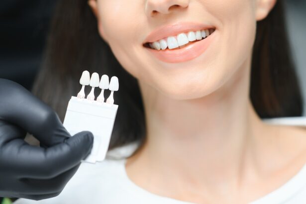 Are Veneers Reversible and What To Know