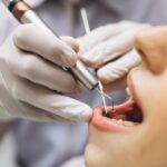 Tips for Navigating Life with a Root Canal