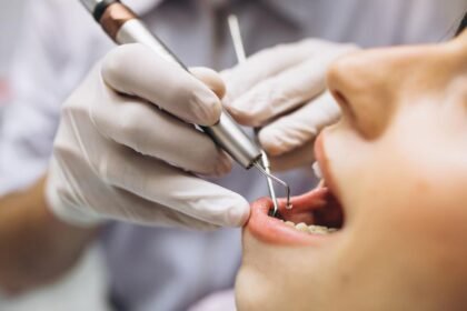 Tips for Navigating Life with a Root Canal